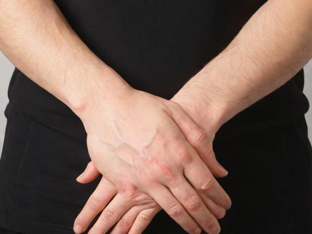 杭州腋臭手术多少钱？揭秘杭州腋秀专科狐臭手术费用