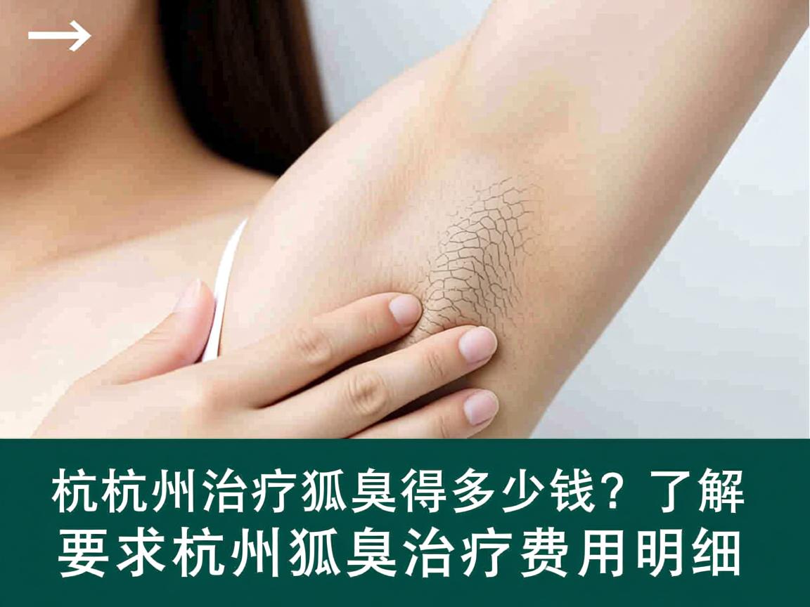杭州治疗狐臭得多少钱?了解杭州狐臭治疗费用明细 杭州治疗狐臭得多少钱?了解杭州狐臭治疗费用明细