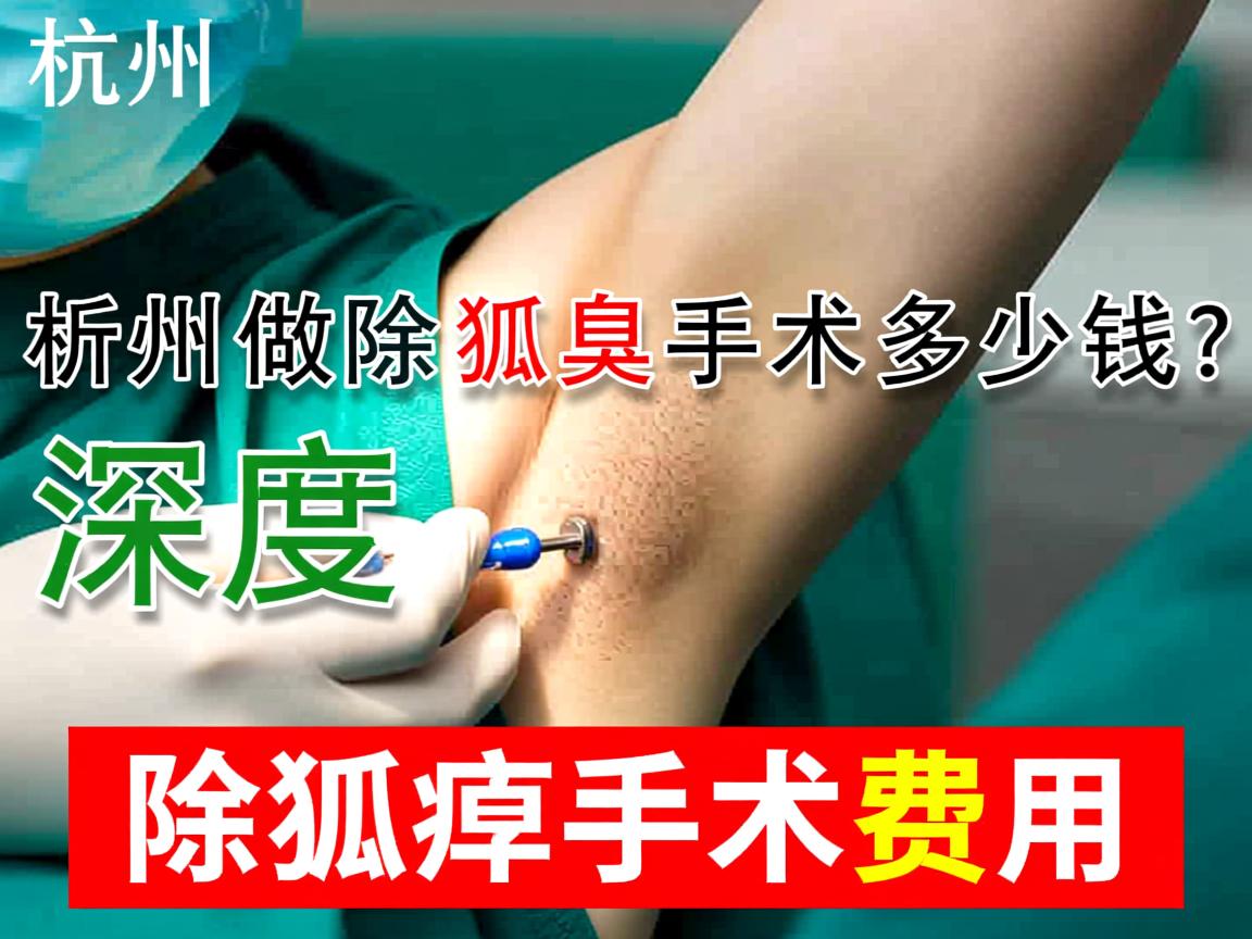杭州做除狐臭手术多少钱?深度解析除狐臭手术费用 杭州做除狐臭手术多少钱?深度解析除狐臭手术费用